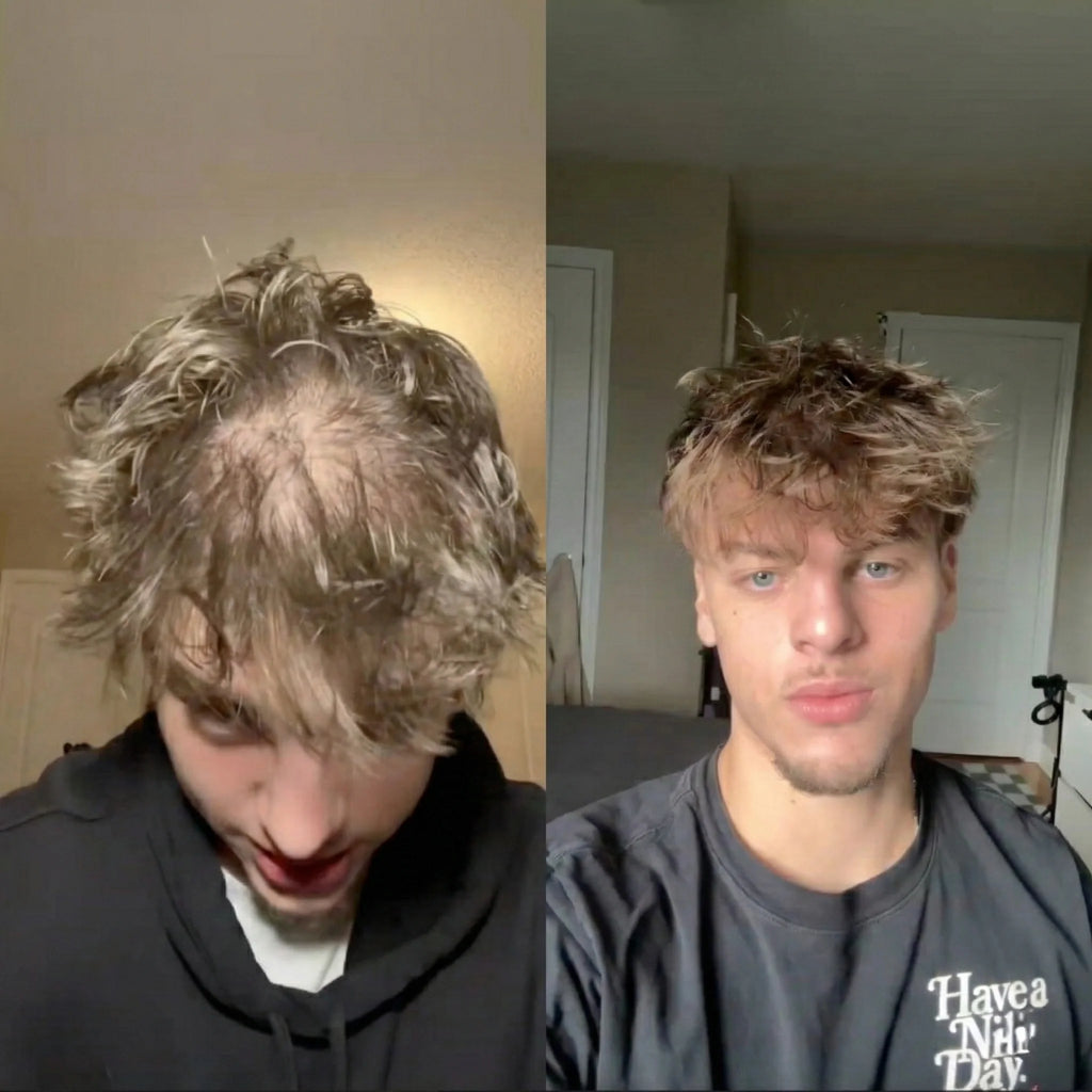 VERTEX Hajnövekedési Spray