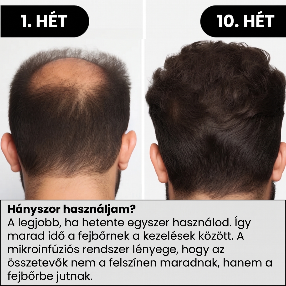 VERTEX Hajnövekedési Szérum