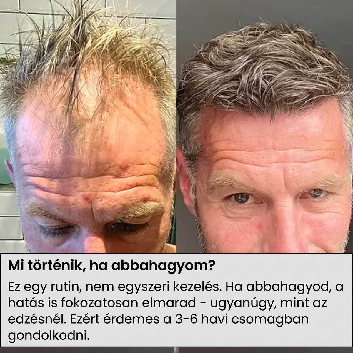 VERTEX Hajnövekedési Szérum